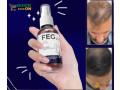 feg-plus-hair-growth-spray-price-in-swabi-03001819306-small-0