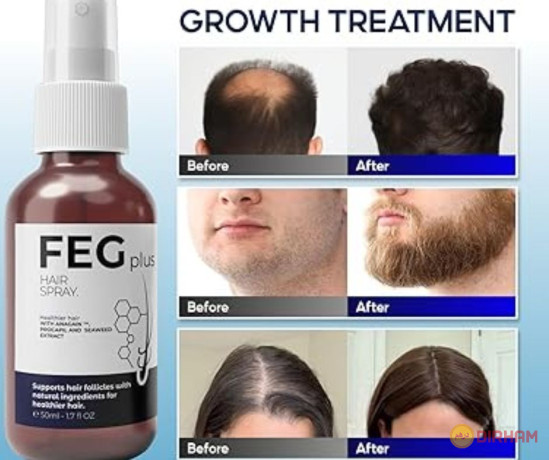 feg-plus-hair-growth-spray-price-in-karachi-03055997199-big-0