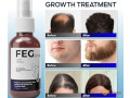 feg-plus-hair-growth-spray-price-in-darya-khan-03055997199-small-0